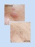 Allies Of Skin Molecular Barrier Recovery Cream Balm